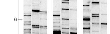 Consider the DNA Mapping Problem Begin with an isolated strand of DNA Digest it with restriction enzymes