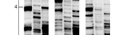 Can accurately sort DNA fragments that differ in length by a single nucleotide Use fragment lengths to