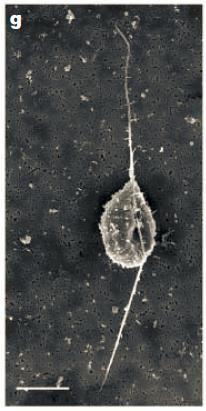 Oospores Zoospore