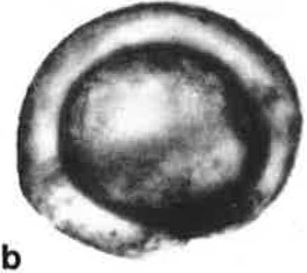 In order to determine the presence of a perine, the spores were treated with 1 N NaOH, according to the method devised by Erdtman ( 1 960) and modified by Gastony (1974) and as used by Gastony and