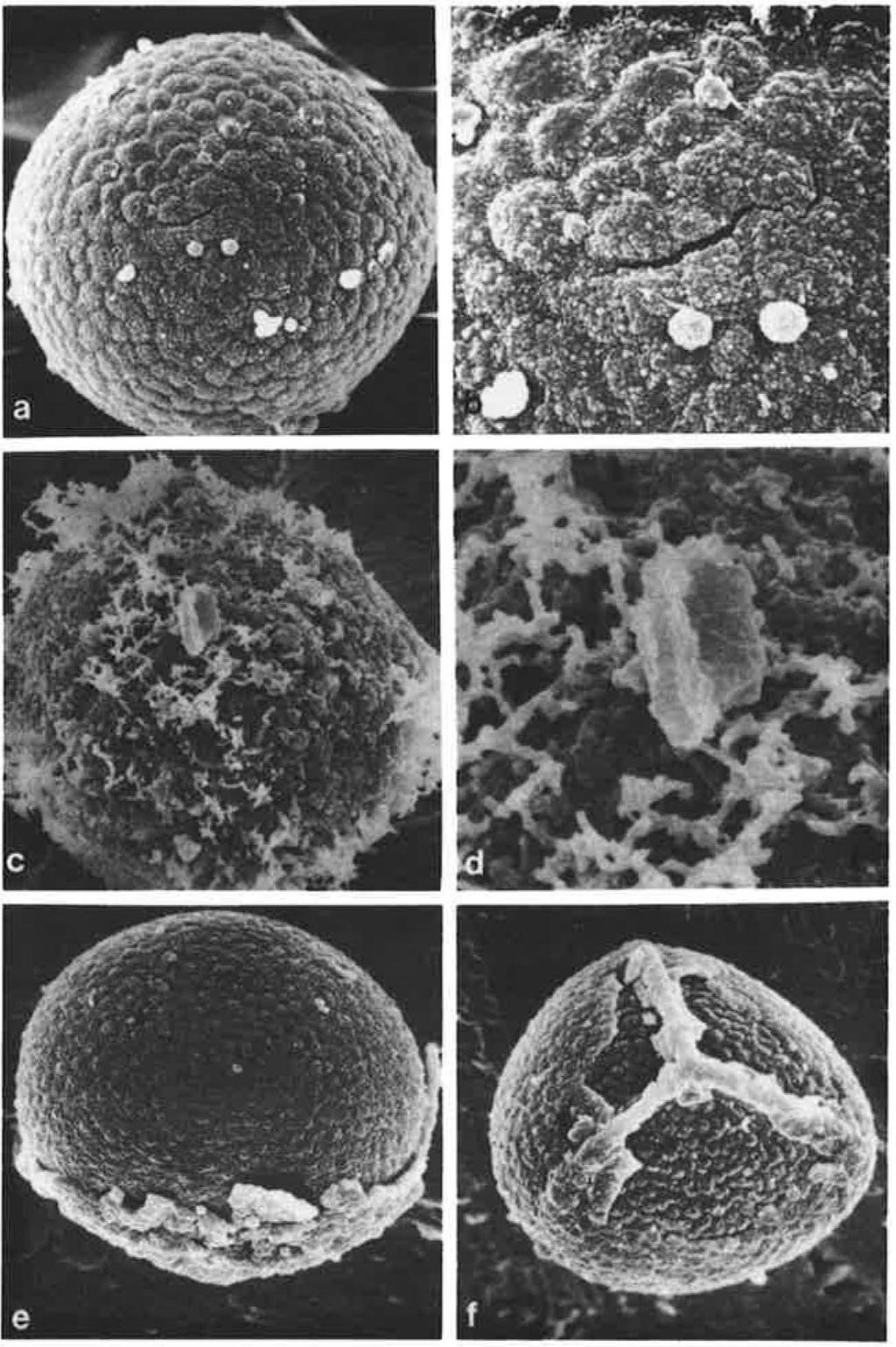 QUIRK & CHAMBERS: SPORE CHARACTERS IN CHEILANTHES 393 FIGURE 6. Spores of C. sieberi : a, C.