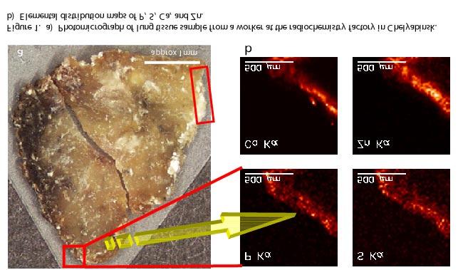 Examples of XRF Imaging with SR X-Ray Fluorescence Studies of Elements in Human Lung Tissue M.