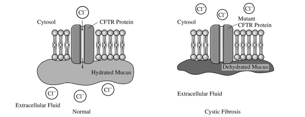 3. Cystic fibrosis is a recessively inherited disorder that results from a mutation in the gene encoding CFTR chloride ion channels located on the surface of many epithelial cells.