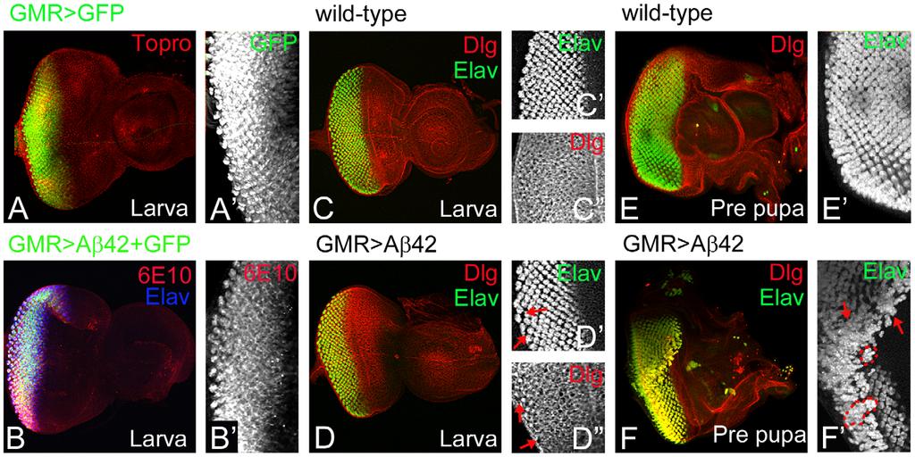 Role of JNK Signaling in Neurodegeneration Figure 1. Misexpression of amyloid-beta 42 (Aß42) induces cellular phenotypes in the differentiating retinal neurons.