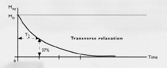Relaxation processes The perturbation of the magnetization has a limited life-time Relaxation returns M to its original (lower energy) state (exponentially) Longitudinal relaxation increases Mz to M