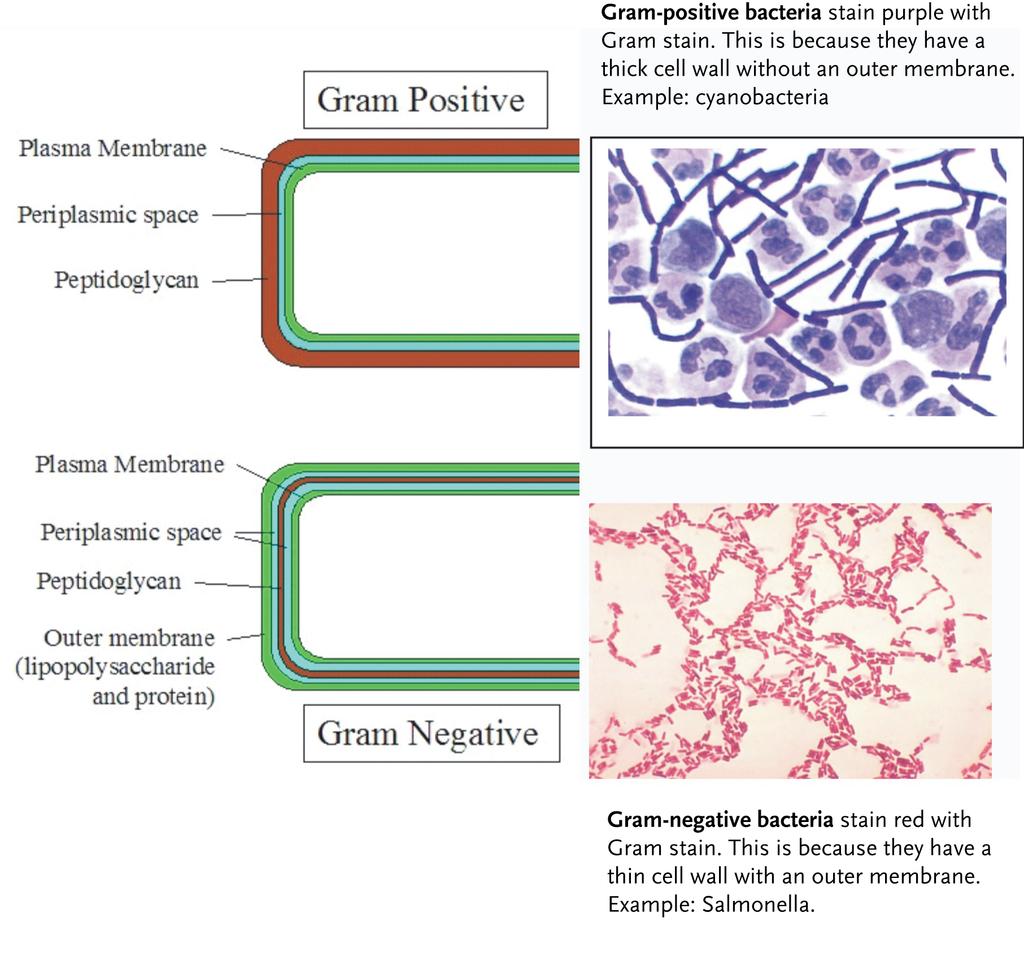 Classification of Bacteria: Different types of bacteria stain a different color when stained with Gram stain. This makes them easy to identify.