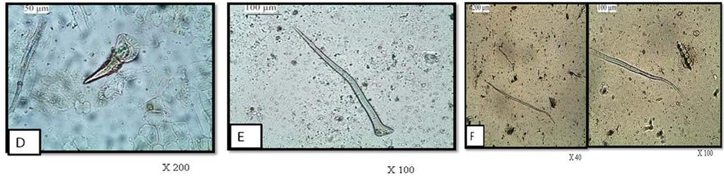 cystolith cells containing calcium carbonate which is confirmed by using Conc. HCl giving effervescence.