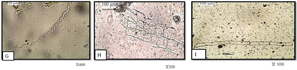 Fig 8: (A) Fragment of upper epidermis showing cystolith cell (x100). (B) Fragment of upper epidermis showing anomocytic stomata (x400).
