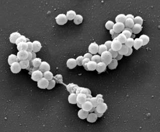10. The photograph below shows bacteria that have developed resistance to antibiotics. They are called MRSA bacteria.