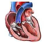 Srce (Statlog heart - sh): zadatak je predvideti odsutnosti ili prisutnosti bolesti srca na osnovu starosti, pola, odgovarajućeg tipa bola u grudima, krvnog pritiska u mirovanju, nivoa holesterola i