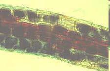 Vesicular-arbuscular mycorrhiza Ericoid