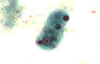 Protozoa (feeding on bacteria,