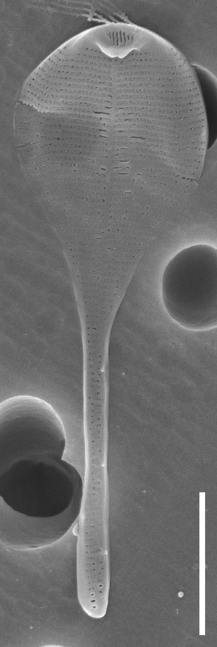 Fig. 4. Asterionellopsis thurstonii Ehrman (B 40 0041334). One of the valves on the DMF SEM stub 245-11 deposited at BGBM. We are grateful to Dr.