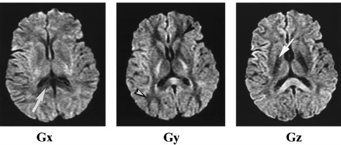 Weighted Images From: -weighted MR of the Brain, by Pamela W.