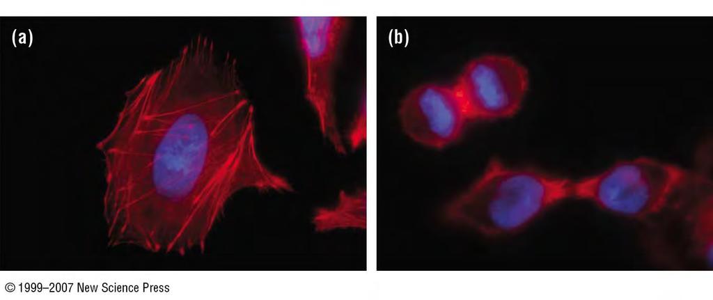 Mammalian cells growing in culture (Red: actin;