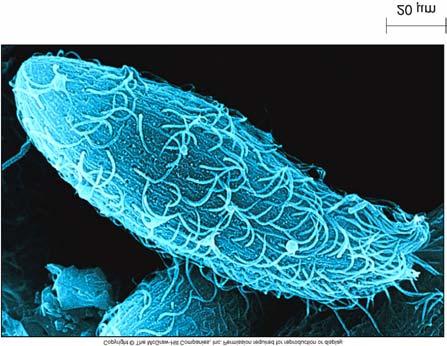 ink Aspergillus, multicellular mold viewed with scanning EM Fig. 01.