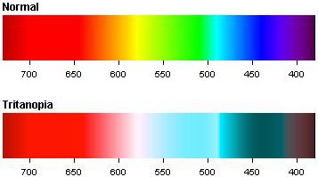 Color Blindness: Trianopia