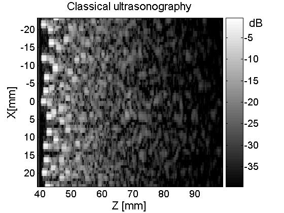 Detection and imaging in a random medium Experimental configuration Array of transducers X L=20 mm Z a= 40 mm TARGET: steel hollow cylinder φ=15mm Random scattering sample made of steel rods (le=7.
