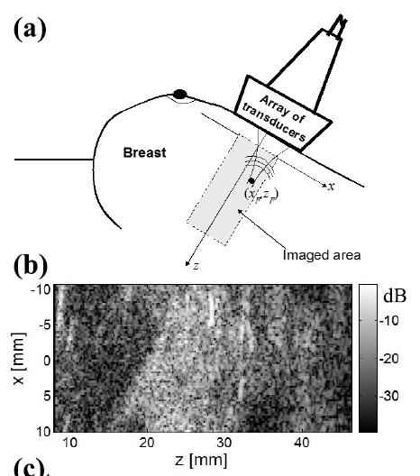 Multiple scattering in weakly scattering media Ultrasound imaging Human soft tissues (le 100 mm) Human soft tissues are known for being weakly scattering, le>ct Multiple scattering is usually