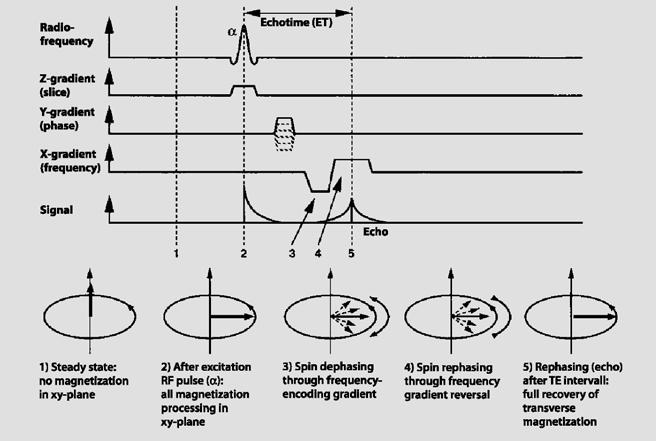 PULSE SEQUENCES Gradient echo Gradient Echo (GRE) Sequences They are also known as gradient-recalled echo or fast field echo (FFE) sequences.