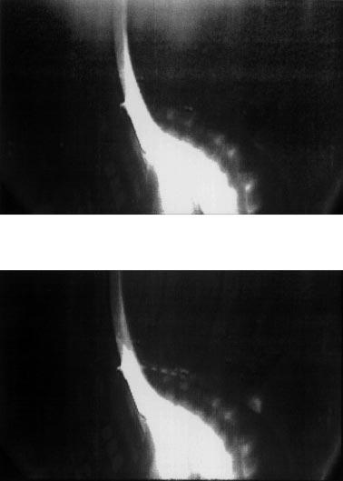 Fig.1. CCD images for R launcher - R pol.lim = and P LH = 3. MW. ( a) F =, (b) F =. 1 1 el./s. Fig.1. CCD images for F =.3 1 1 el./s and P LH =. MW. (a) R launcher - R pol.lim. =, (b) R launcher - R pol.