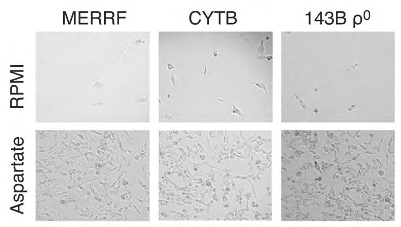 Aspartate is sufficient to enable proliferation of cybrids with