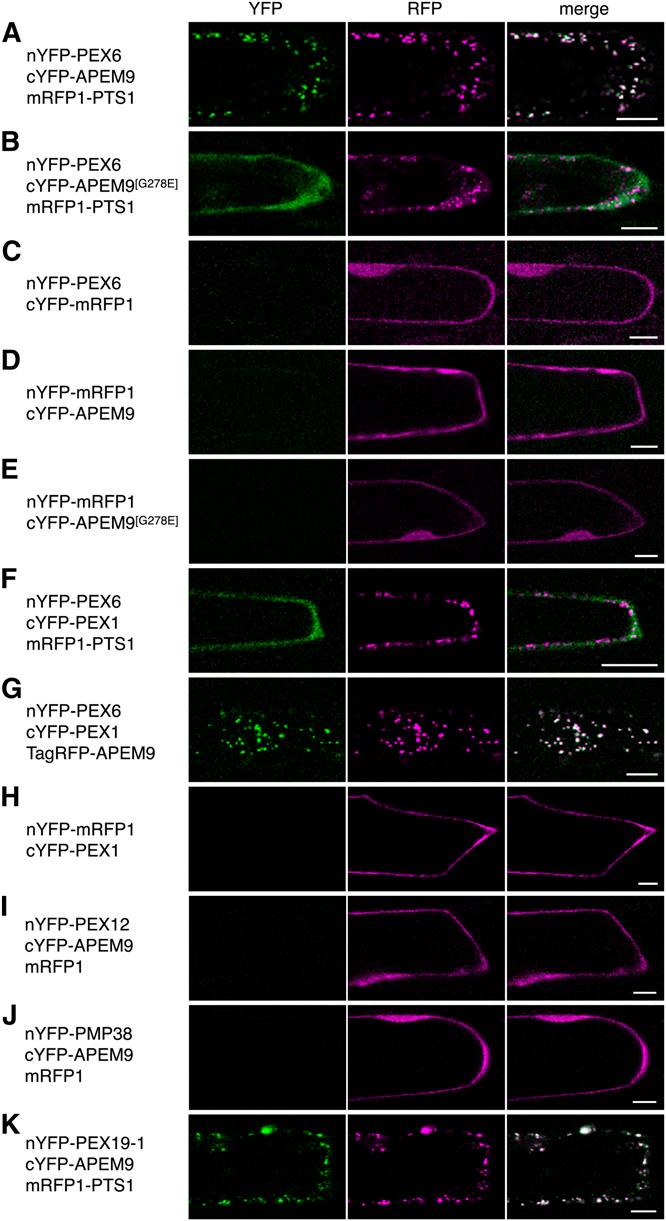 Plant Peroxin APEM9 1579 APEM9 Gene Expression in Arabidopsis Peroxisomes are involved in several metabolic processes throughout the plant life cycle, such as lipid metabolism and photorespiration