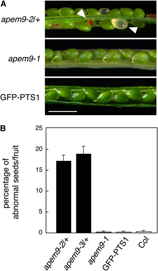 To investigate the effects of defective APEM9 on significant peroxisomal functions, we determined the fatty acid b-oxidation activity of the apem9 mutants.