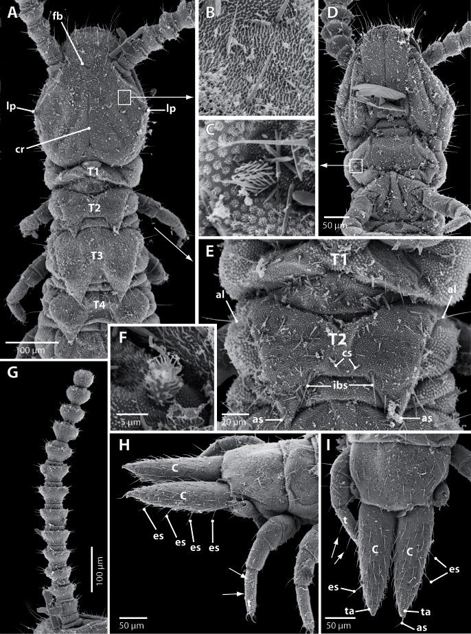 DOMÍNGUEZ CAMACHO M. & VANDENSPIEGEL D., Scolopendrellidae from the Afrotropics Fig. 1. Symphylella erecta sp. nov., holotype (dorsal and lateral views) and paratype MRAC 22149 (ventral view). A. Head and first 4 tergites (T1, T2, T3, T4), dorsal view.