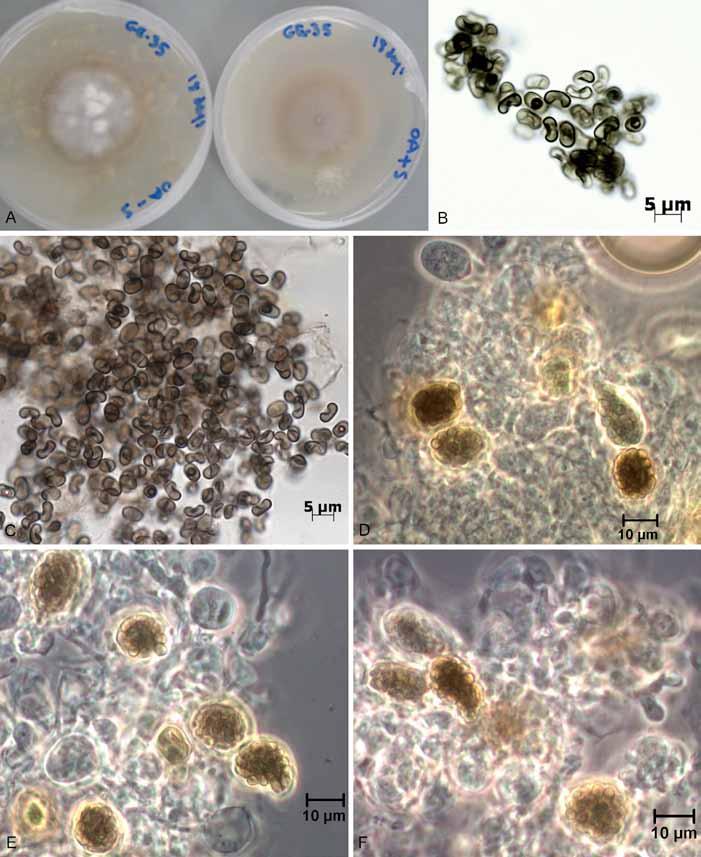 Antibiotic producing Westerdykella reniformis sp. nov. Fig. 5. Macro and micro-morphology of Westerdykella reniformis (RKGE 35 = DAOM 242243). A.