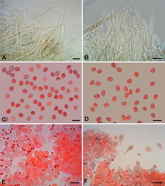 Muñoz et al. Fig. 3. Leucoagaricus variicolor. Microscopic characters. A B. Elements of the pileipellis. C D. Spores (in ammoniacal Congo red). E F. Cheilocystidia (in ammoniacal Congo red).