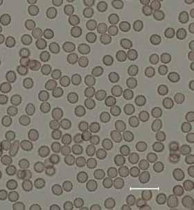 Description: Colony diameters after 7 d incubation at 25 C on CYA (Fig. 6a) 65 78 mm, MEA (Fig. 6b) 57 to > 85 mm, CY20S 50 55 mm, OA 55 60 mm, CREA (Fig.