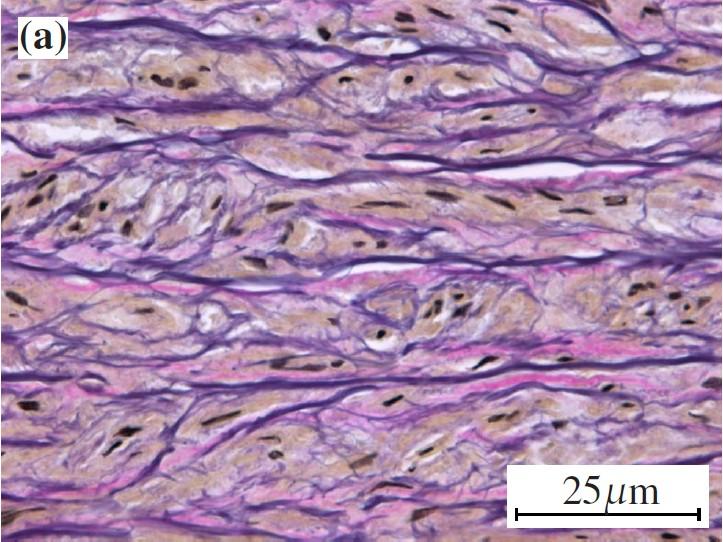 Collagen Fibers in Arterial Layers 6 In each arterial layers, the isotropic ground matrix is reinforced by two