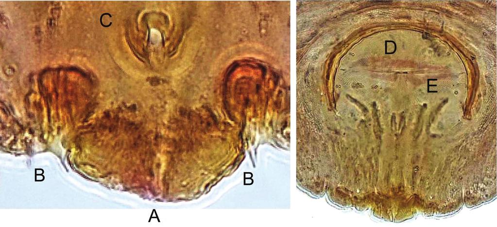 6 Insecta Mundi 0218, March 2012 Dooley and Evans Figure 3. Protomorgania koebelei adult female (pygidium).