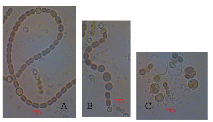 Identification of cyanobacteria Identification of isolated cyanobacteria was done by morphological methods. The strain was viewed at 400x and 1000x using Olympus 21Xi microscope.