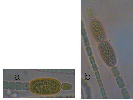 Fig. 1: Micrograph of (a) Cylindrospermum Sp. NDUPC005 (b) Cylindrospermum Sp. NDUPC006 Crude extract only in Petroleum ether and acetone showed antibacterial activity against E. coli (Table- 1).