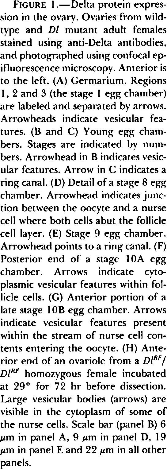 Regions 1,2 and 3 (the stage 1 egg chamber) are labeled and separated by arrows. Arrowheads indicate vesicular features. (B and C) Young egg chambers. Stages are indicated by numbers.