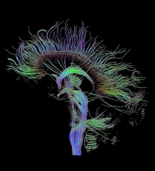 DIFFUSION NMR - Imaging of the DTI data Tractography diffusion tensor magnetic resonance