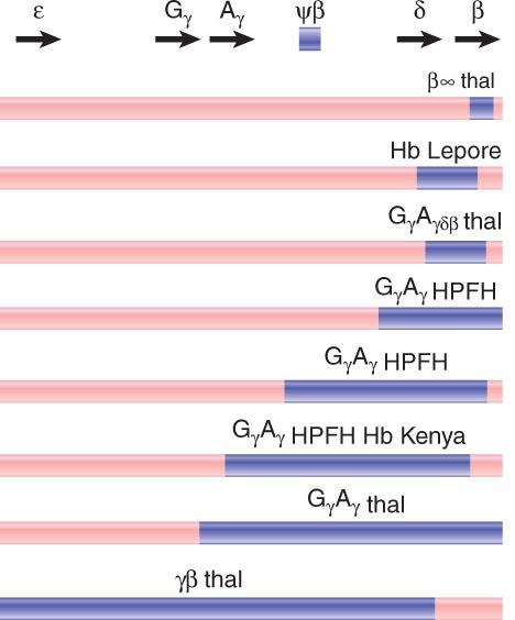 Unequal Crossing-over Rearranges Gene Clusters Hb Lepore An unusual globin protein that results from unequal