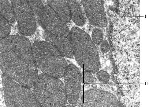 The electron micrograph below shows part of a cell. [Source: M Turmaine, UCL] Identify the structures labelled I and II.