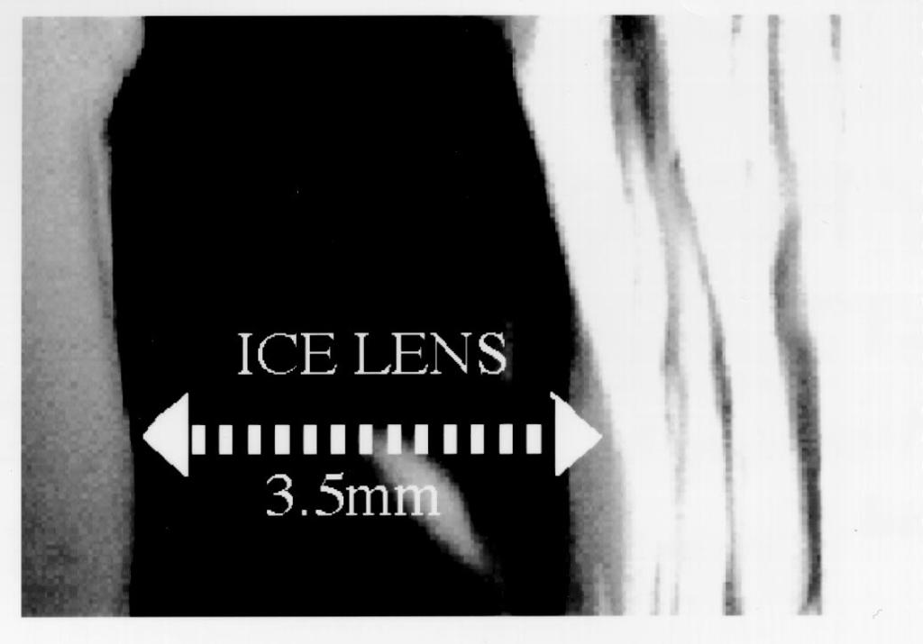 In the first experiment we observed the vicinity of a growing ice lens immediately after the temperature gradient was applied until the warmest ice lens stopped growing.