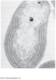 Figure 27.7a Pathogenic bacteria 0.2 m Some E.