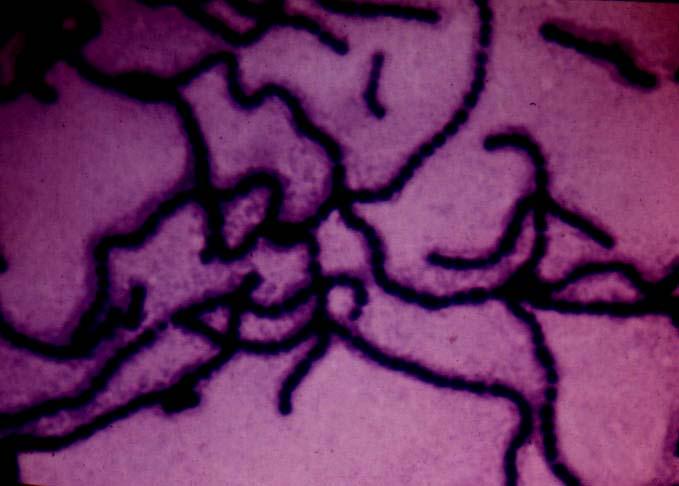 Gram Positive Cells Stain purple Has thick