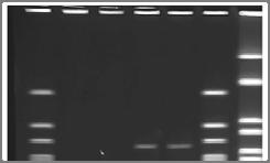 Figure 10.14 DNA fingerprints. 1 2 3 4 5 6 7 Figure 10.15 DNA-DNA hybridization. Organism A DNA Organism B DNA 1 Heat to separate strands.