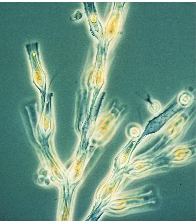 Golden Algae 21 Phylum Chrysophyta ~1,000 described species Unicellular & solitary (most) Colonial (some) Some