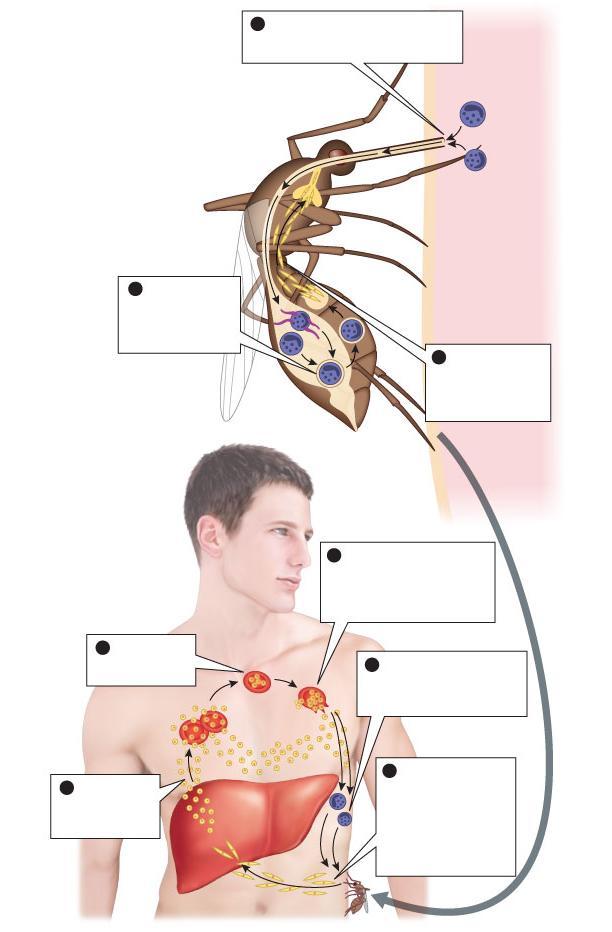 Figure 20-12 The life cycle of the malaria parasite 1 A female Anopheles mosquito bites an infected human and ingests gametocytes, which become gametes (infected human) female gametocyte male gamete