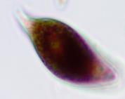 Red Eyespot Euglena agilis Euglena
