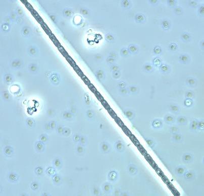 Filamentous Cyanobacteria consist of chains