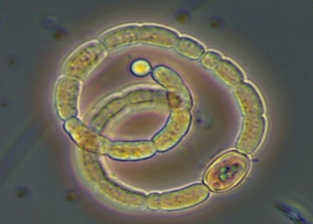 Filamentous Cyanobacteria consist of chains