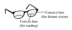 Corrected by- - convex lens of appropriate power Presbyopia: It is that defect of vision due to which the power of accommodation of the eye usually decreases with age.